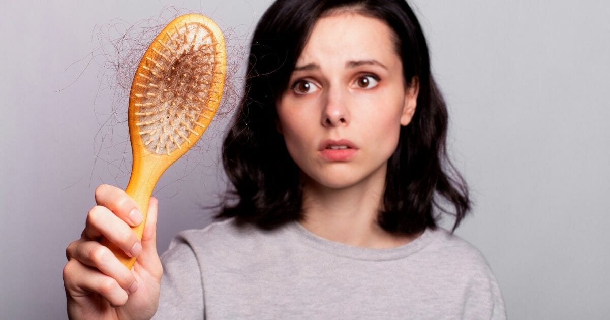 alopecia donne