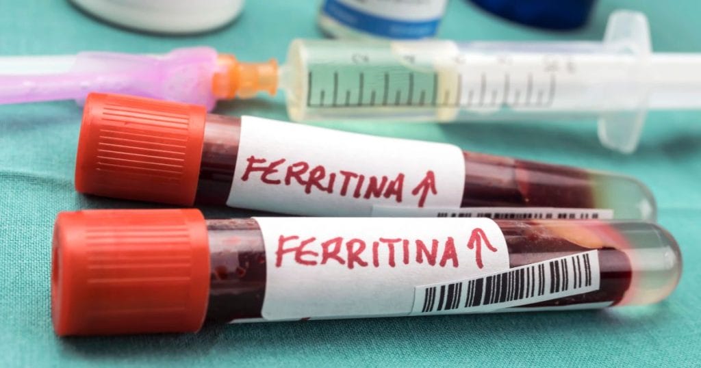 fiale con sangue ed etichetta con scritto ferritina