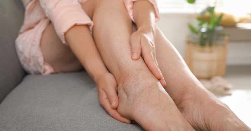 donna massaggia gambe gonfie